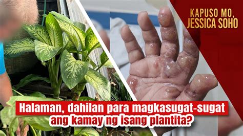 Sugat sa kamay in english in English with examples .